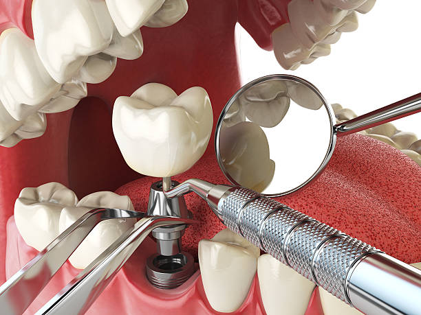 Best Same-Day Emergency Dental Services in Mcloud, OK